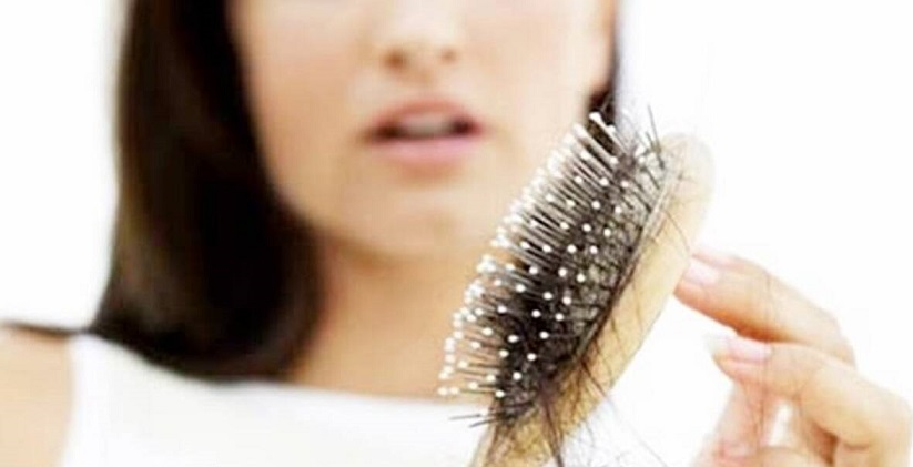 Solution to prevent hair fall
