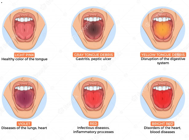 How to recognize the disease by looking at the color of the tongue